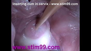 Insertion semen cum in cervix wide stretching p